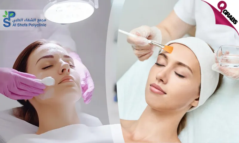 Instant Glow: Chemical Peel for Ladies & Men at Al Shefa Polyclinic!